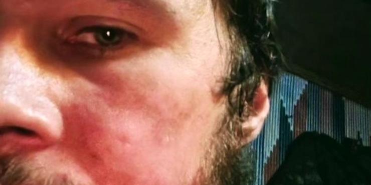 Військовий зі 110-ї бригади Біляк розповів про важкий відхід з укріпрайону “Зеніт” під Авдіївкою