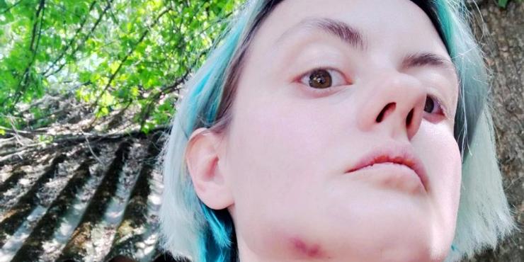 В Ужгороді п’яний працівник військкомату побив дружину військового: яка реакція поліції
