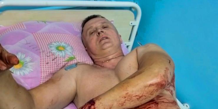 У Покровську під час ракетного удару поранило поліцейського — героя фільму “20 днів в Маріуполі”