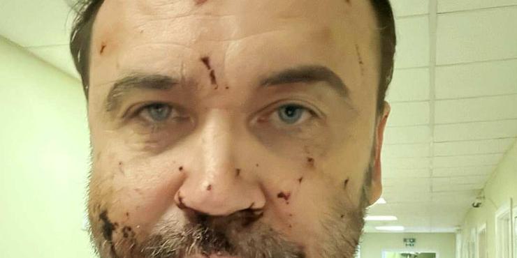 Пономарьов розповів, як “Шахеди” атакували його будинок дві ночі поспіль: “Було багато крові”